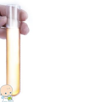 试管婴儿包生男孩公司