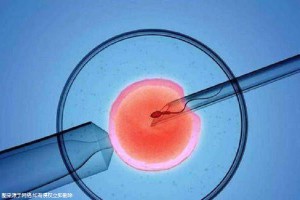 遗传阻断案例